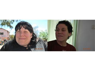 Bypass gástrico antes y después - 592708