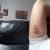Remoción de tatuaje completa!